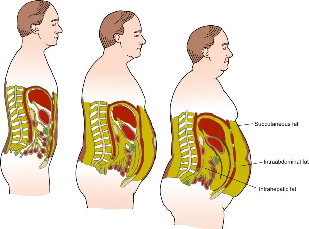 Understanding Belly Fat